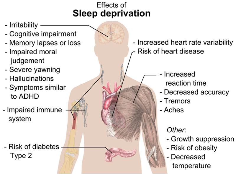 Sleep deprivation is the early cause of serious disease