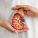 Kidney Cyst